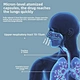 breathing machine for asthma